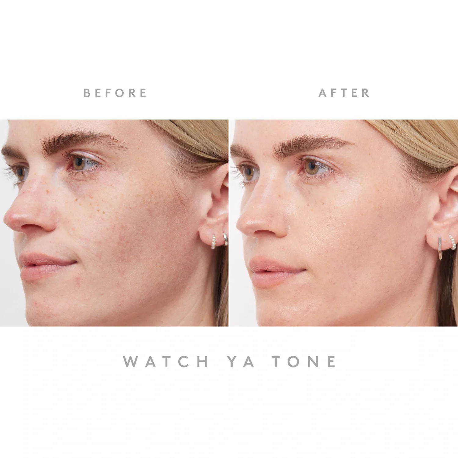 watch ya tone - niacinamide leke karşıtı serum