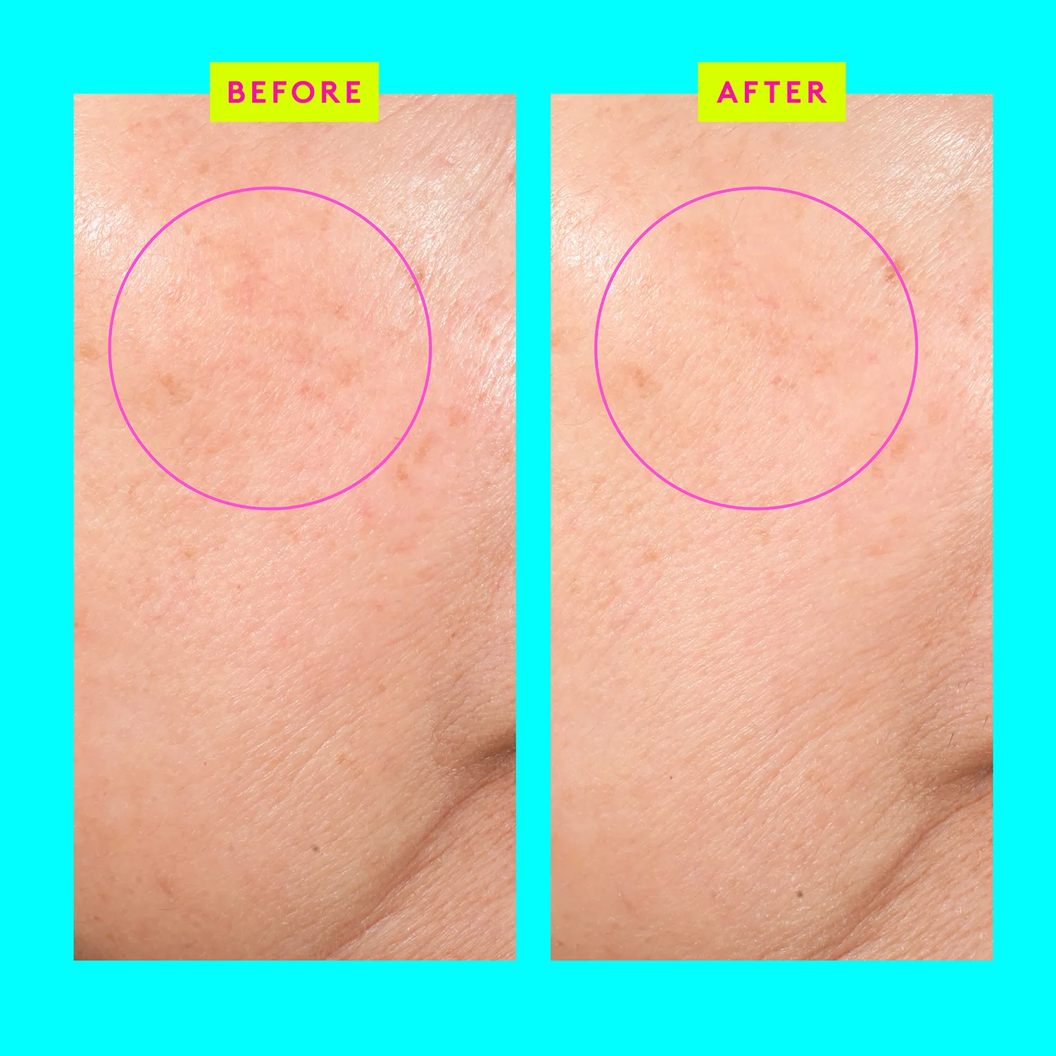 bouncy brightfacial™ - arındırıcı & işıltı veren yüz maskesi