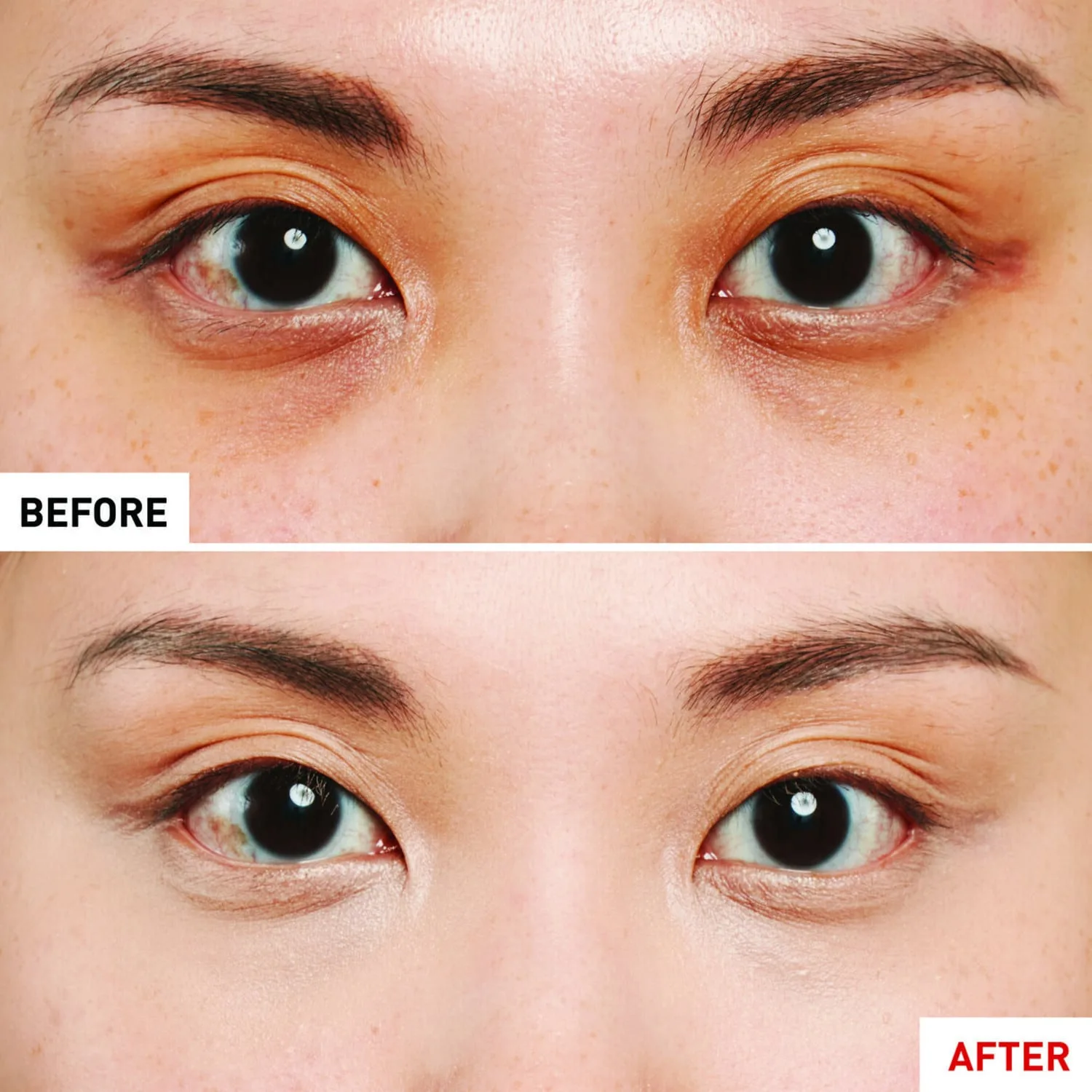 super bb concealer – kapatıcı