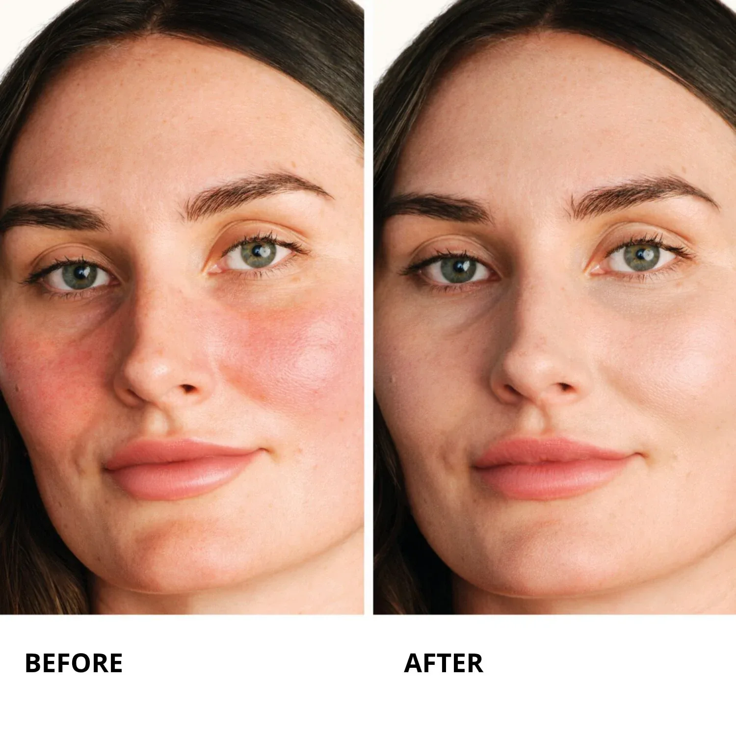 centella red serum - anında yatıştırıcı konsantre serum