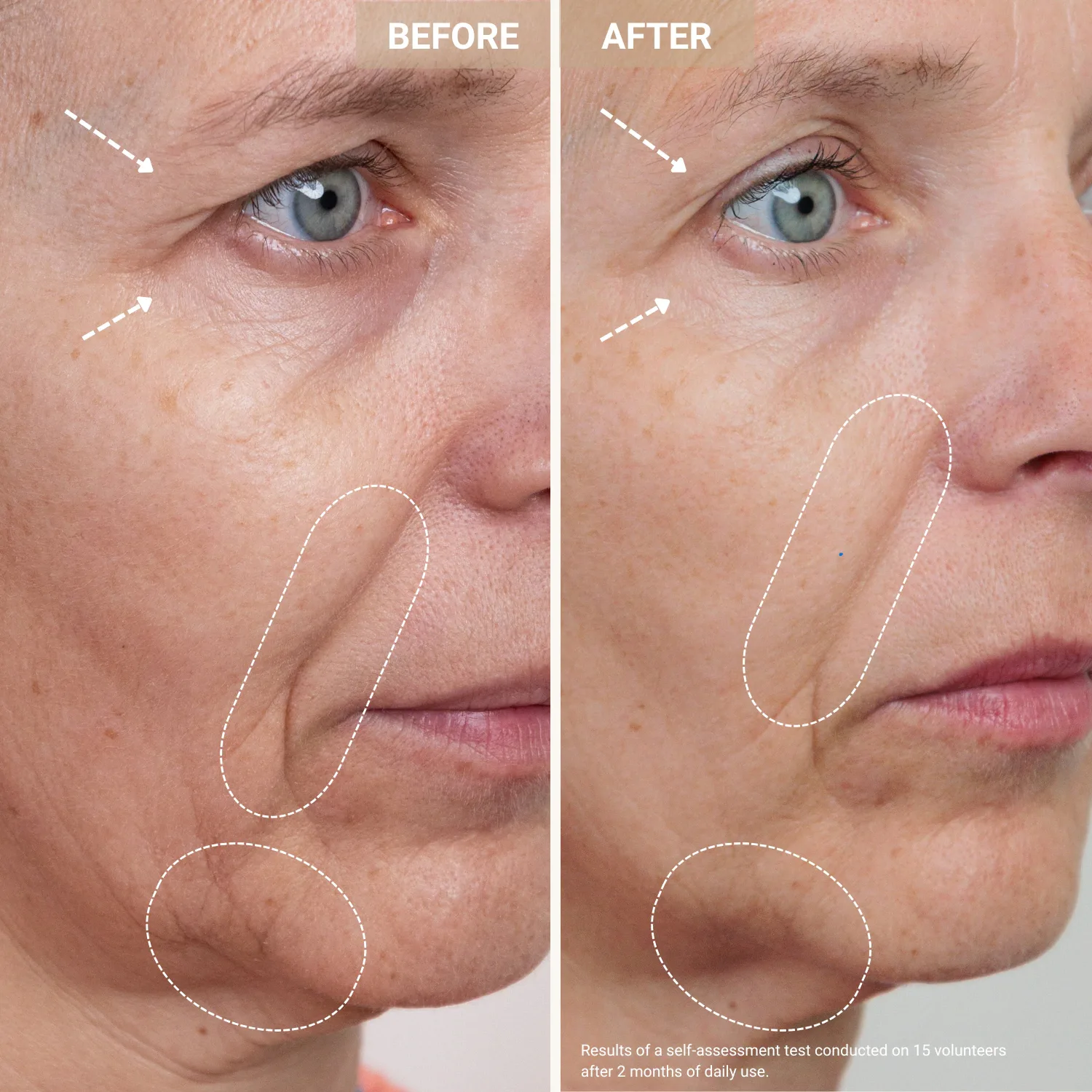 youth serum - bakır peptitleri içeren yaşlanma karşıtı serum