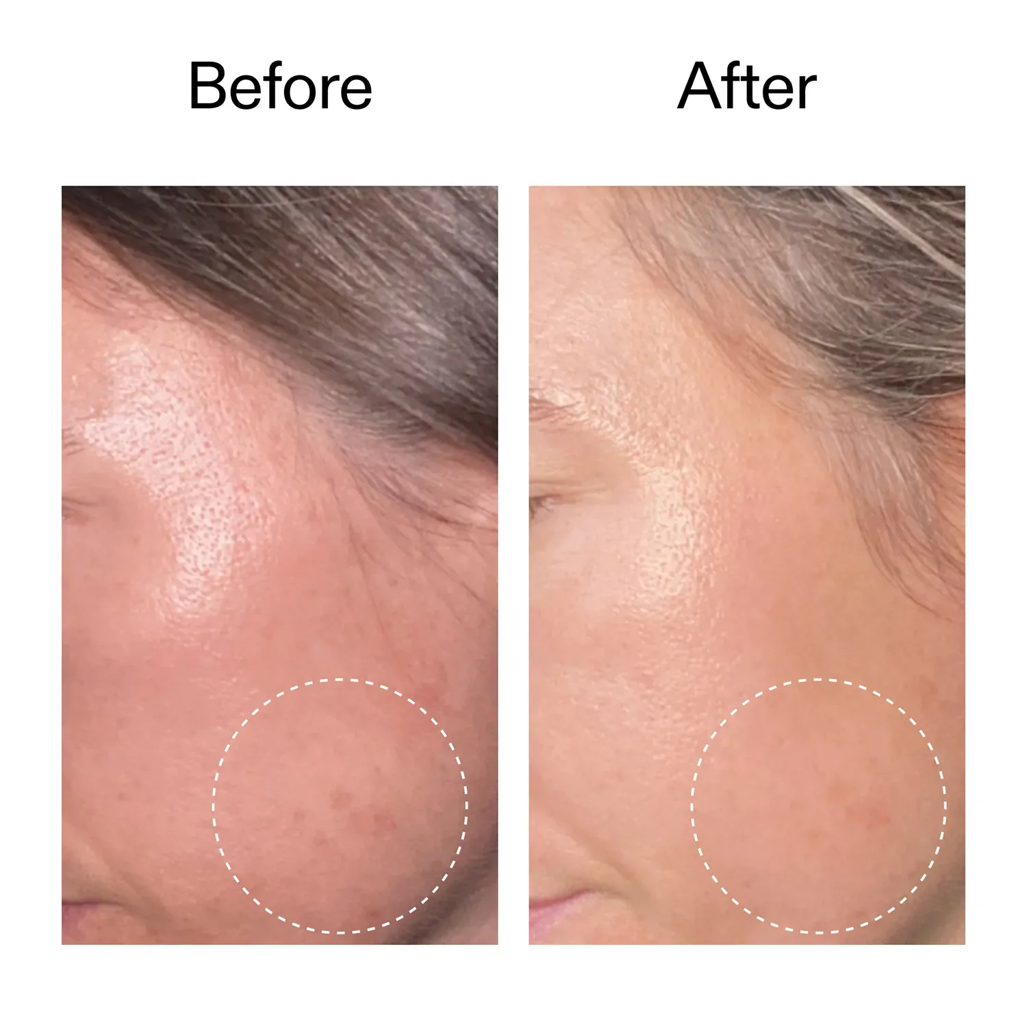 advanced retinal serum - gelişmiş retinal serum