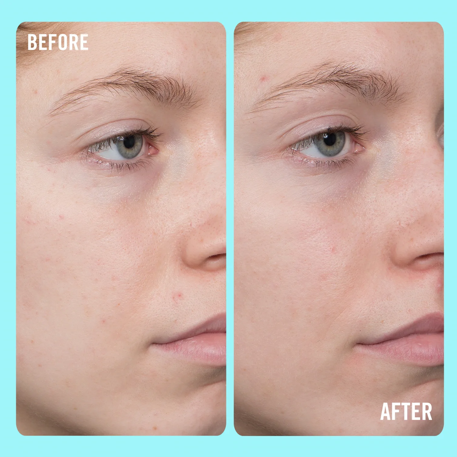 10% vitamin c brightening serum - aydınlatıcı serum