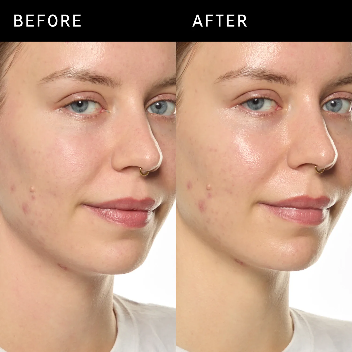 ectoin hydro-barrier serum - nemlendirici ve koruyucu serum