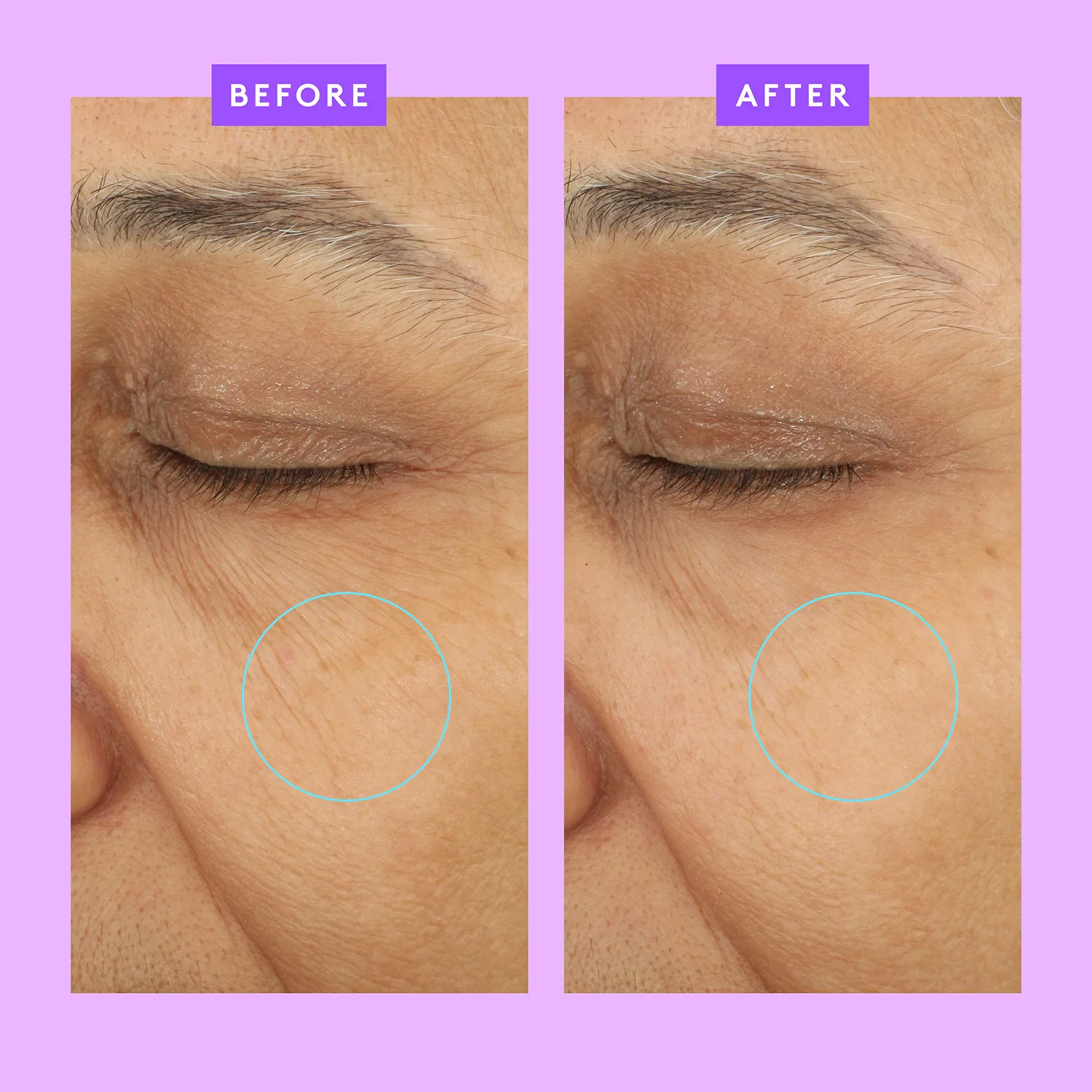 ceramighty™ af eye balm -yaşlanma karşıtı göz kremi