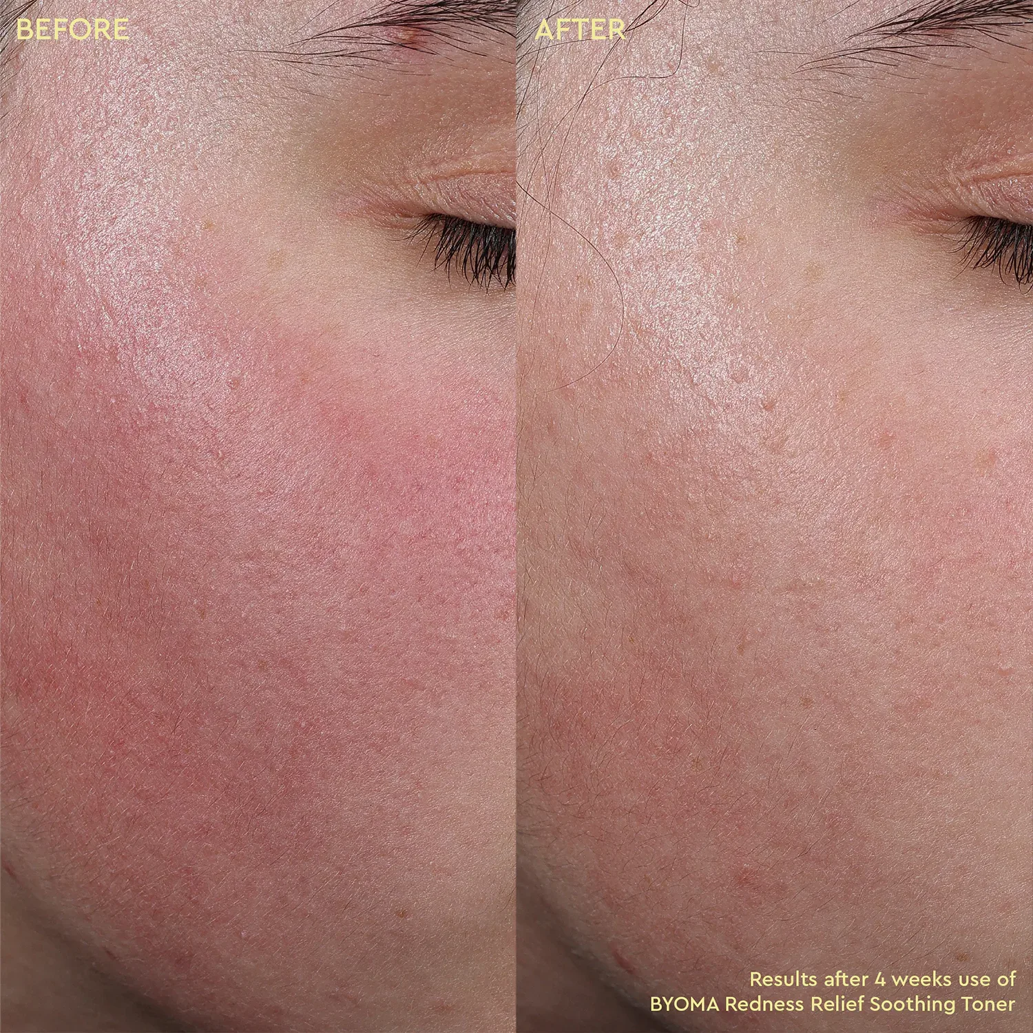 redness relief soothing toner - kızarıklık karşıtı yatıştırıcı tonik