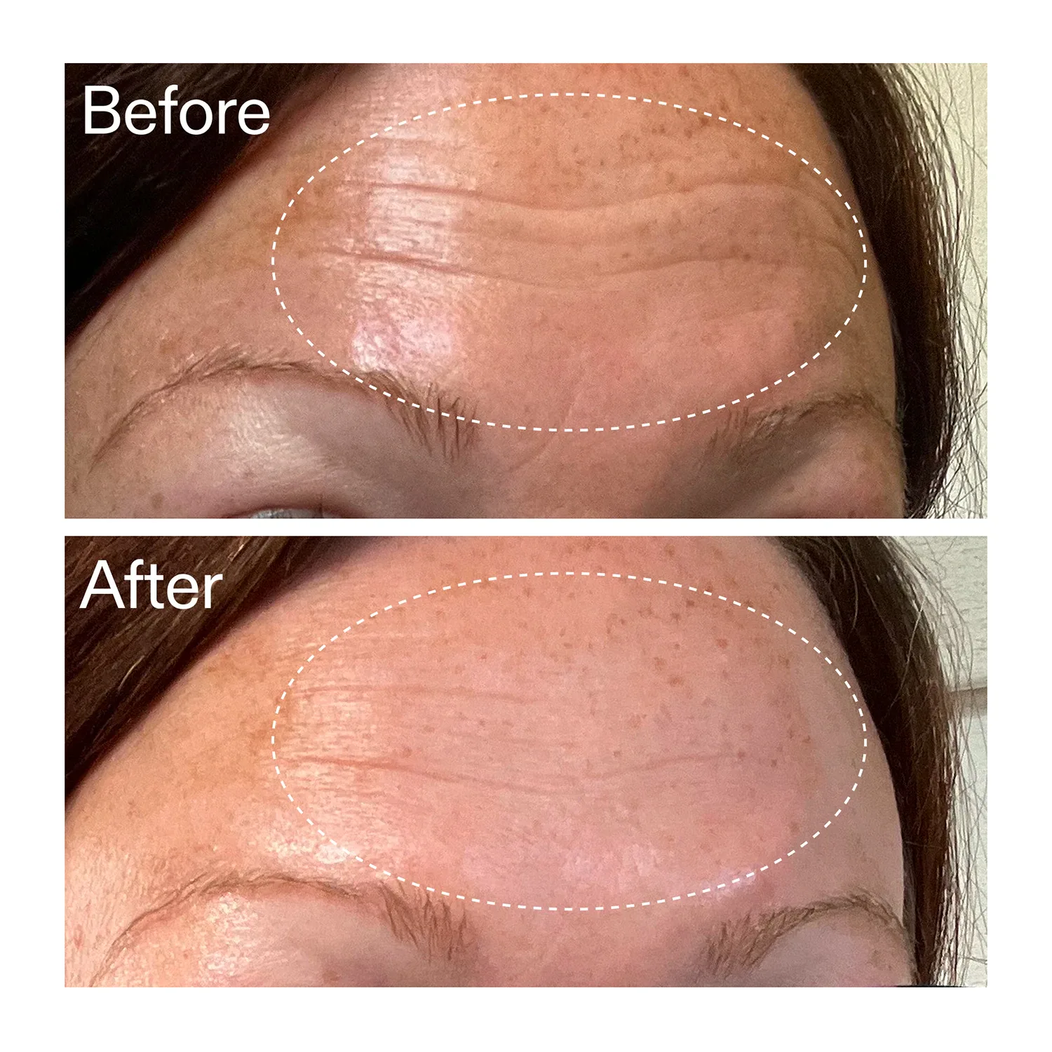 starter retinol serum - retinol başlangıç serumu