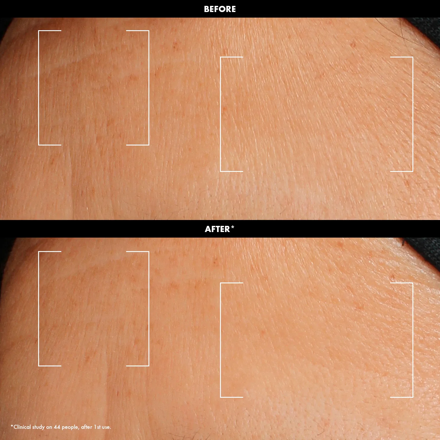 hydrate - hyaluronik + poliglutamik asit i̇çeren nemlendirici dewy bubble serum