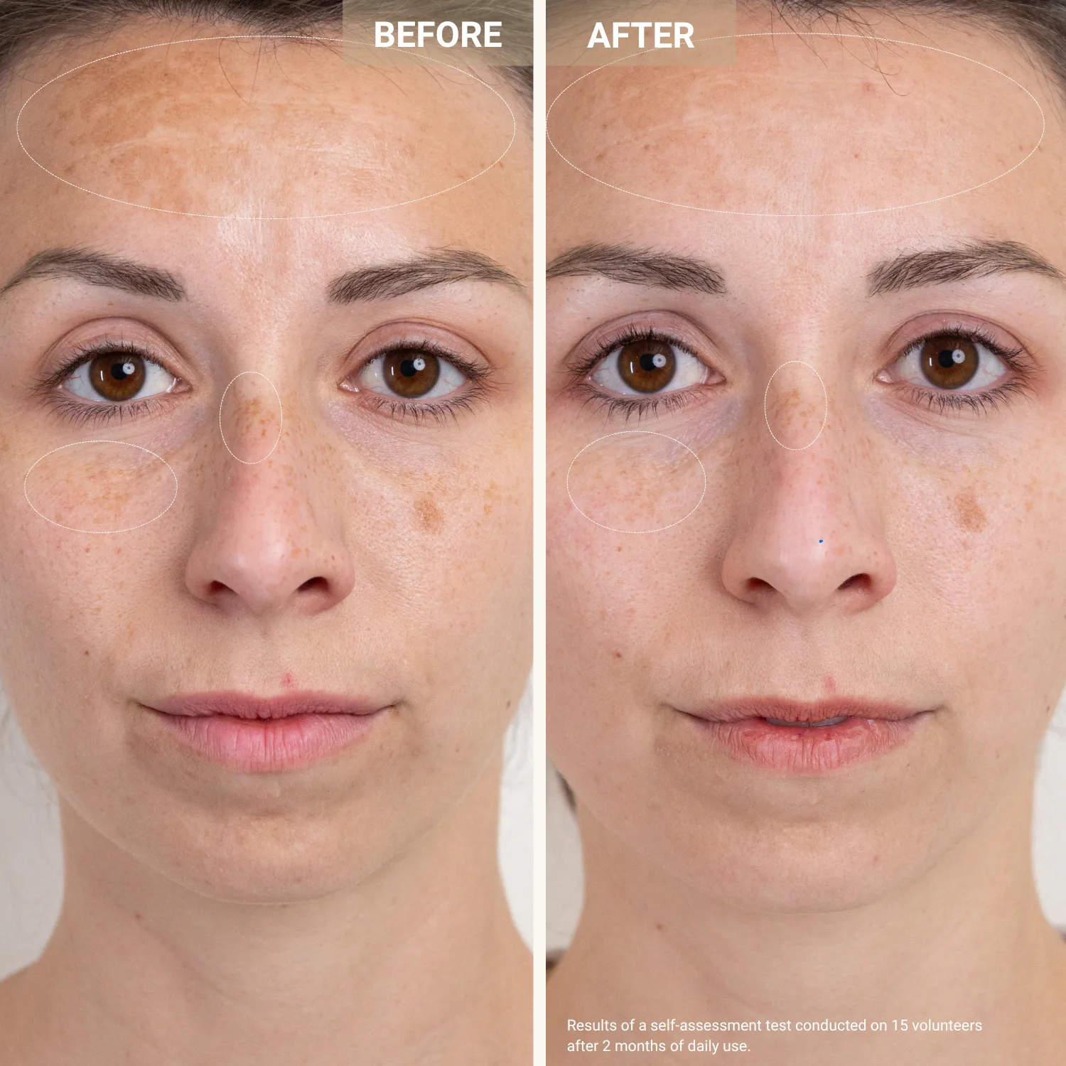 anti-redness clarifying care - kızarıklık ve leke karşıtı serum