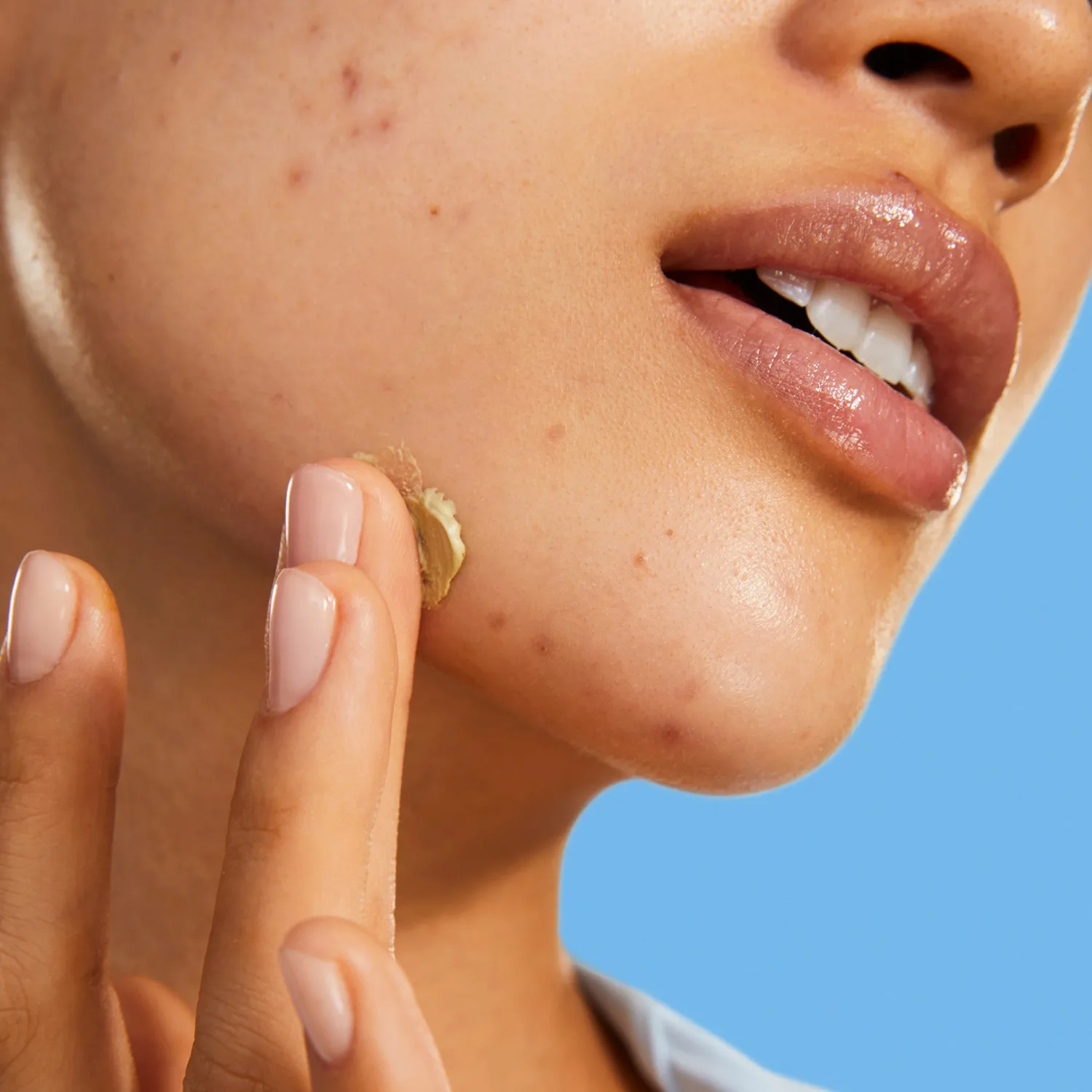 blemish clearing paste - cilt kusurları karşıtı macun
