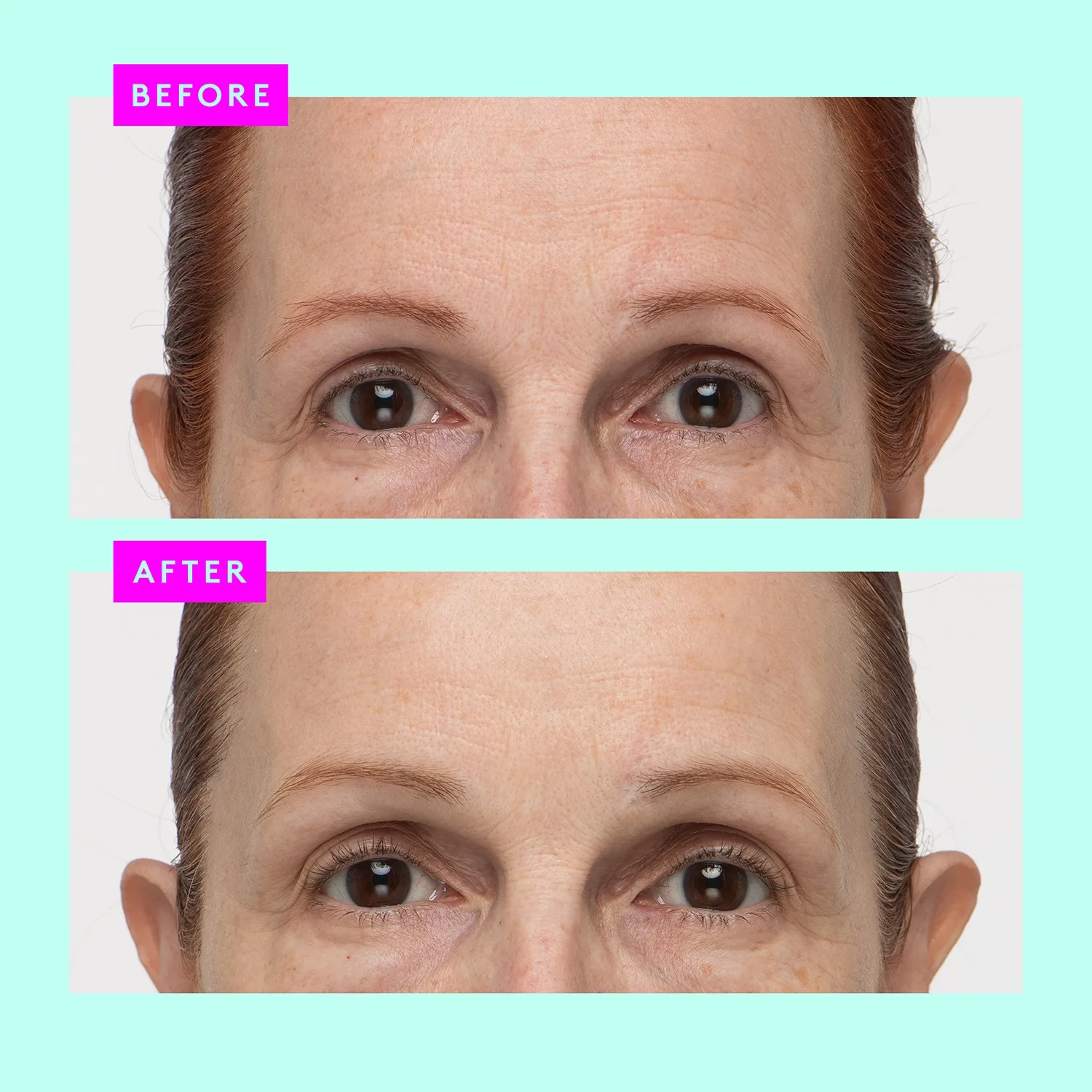 protini polypeptide cream - nemlendirici krem