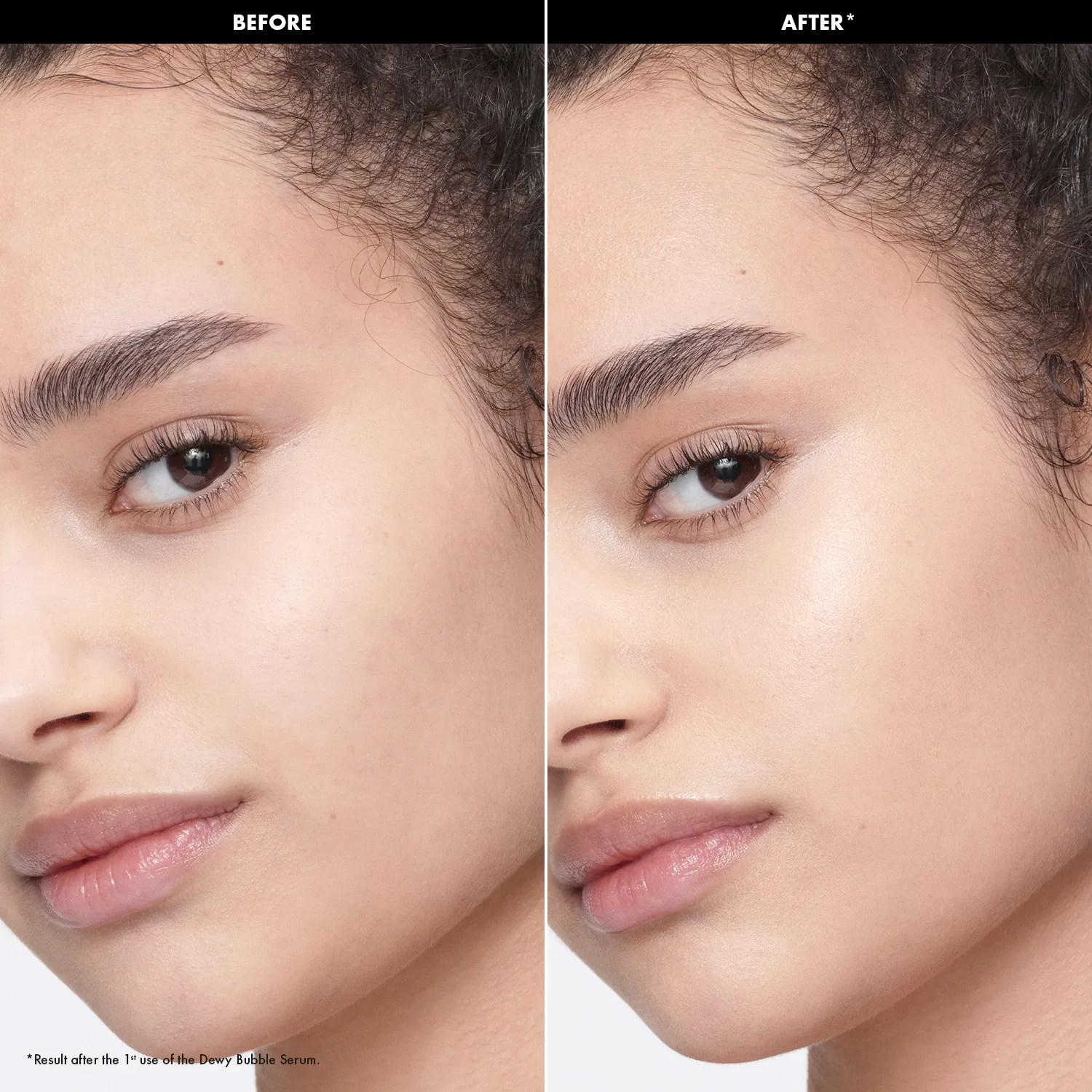 hydrate - hyaluronik + poliglutamik asit i̇çeren nemlendirici dewy bubble serum