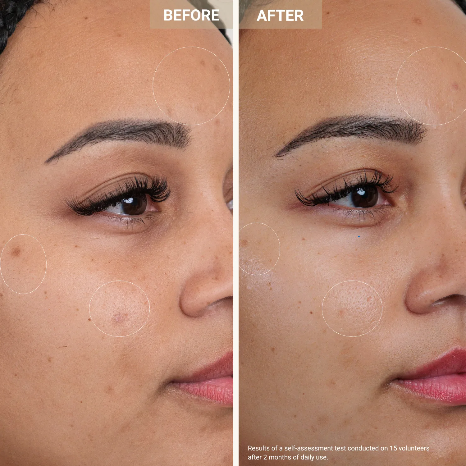 anti-redness clarifying care - kızarıklık ve leke karşıtı serum